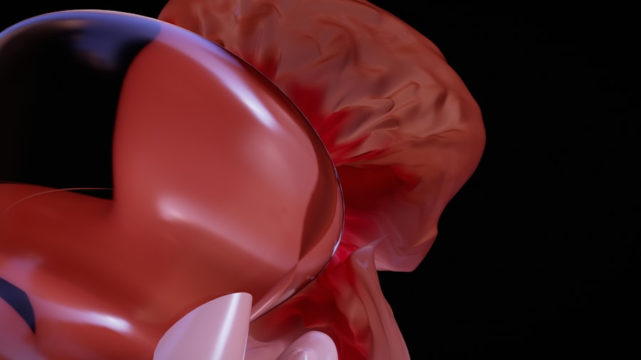 Photo Gallbladder Polyps Treatment