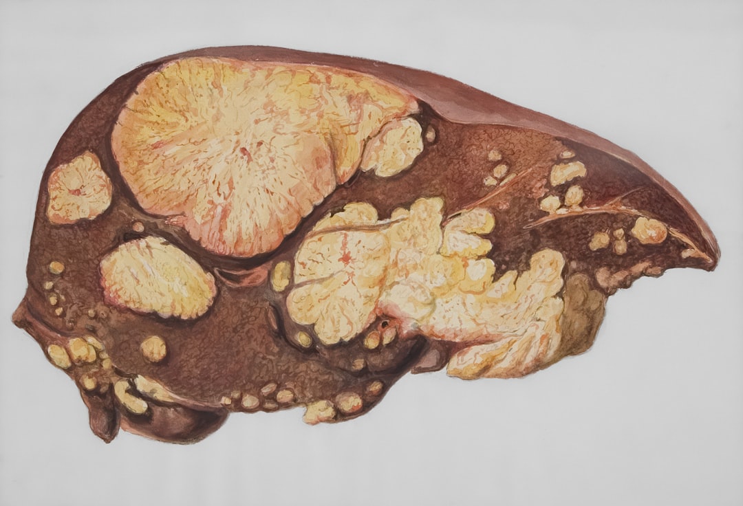 Photo Liver Problem